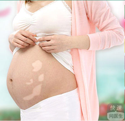 孕妇白癜风患者应该怎么护理